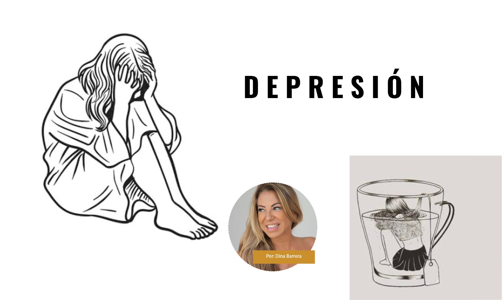 Depresión Depresión
