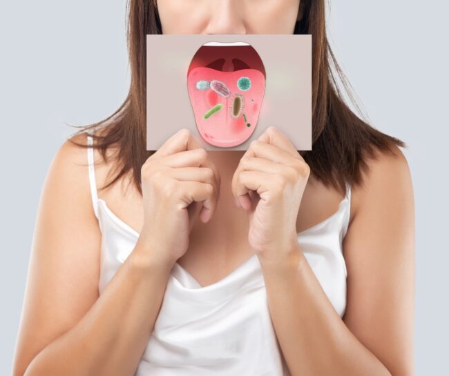 Halitosis 