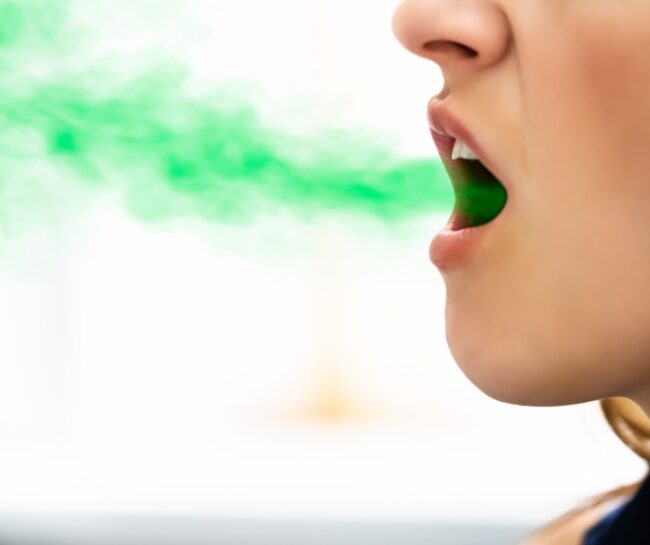 Halitosis 